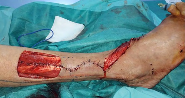 Figure 4: Results at 1 month postoperatively.