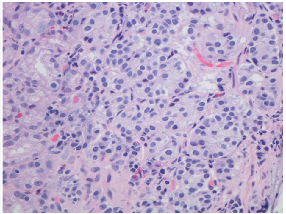 Figure 3: Magnification 400x.