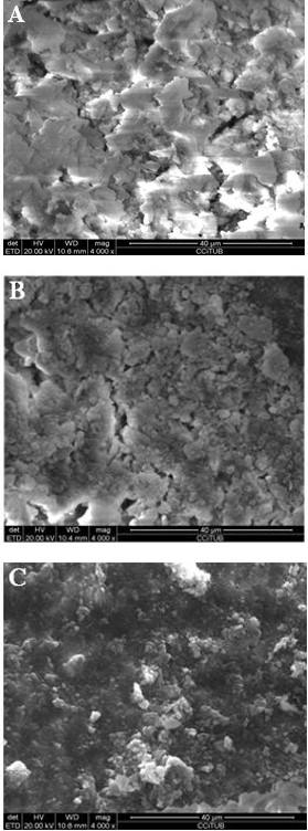 Figure 3: Scanning electron microscope photomicrographs (x4000 magnification). Ionized water solution-irrigated group: (A) Coronal third.