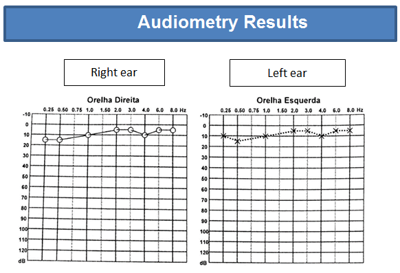 Figure 2: Threshold Tonal Audiometry.