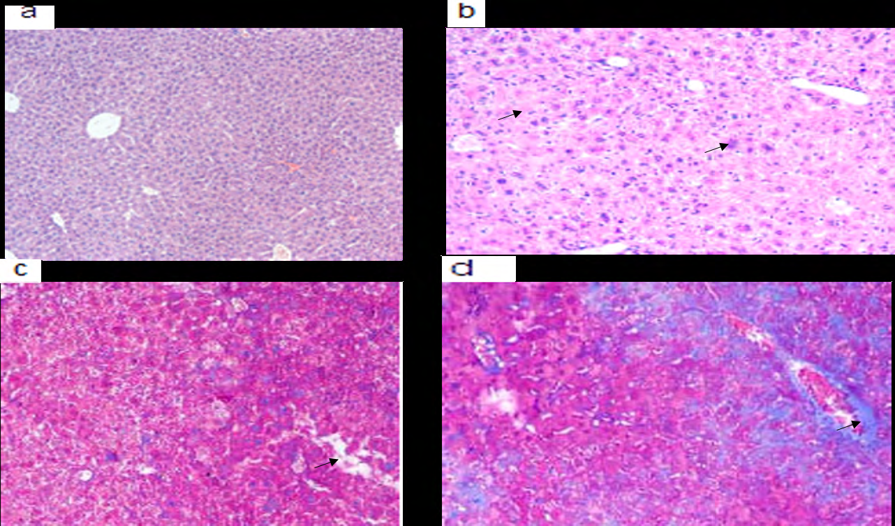 Figure 2: The depicted figure showed (a) normal liver parenchyma (b) the highest dose of gadolinium chloride induce hepatocellular necrosis and enhanced hepatic cell apoptosis (c) pretreatment of gadolinium chloride before and parallel of CCL4 treatment reduce the collagen deposition which visualized by mallory trichrome stain (d) massive collagen deposition by CCL4 stained bluish with mallory trichrome stain 100x.
