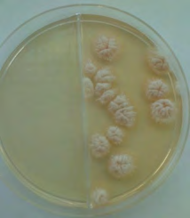 Figure 1: Colony formation on Sabouraud agar exhibited a white, creamy and fluffy appearance.