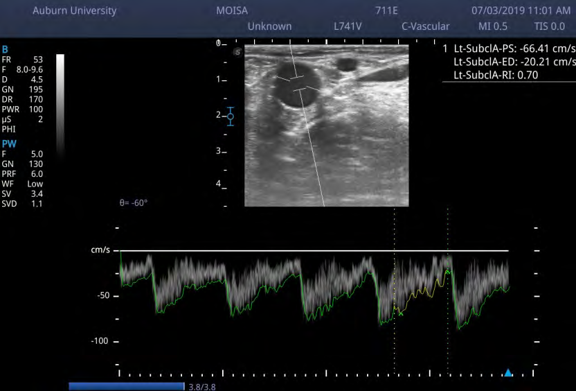 Figure 4: Representative sonogram showing the variation of blood flow indices measured from the uterine artery in pregnant, genotyped beef cows supplemented with rumen- protected niacin and exposed to endophyte-infected tall fescue seeds.