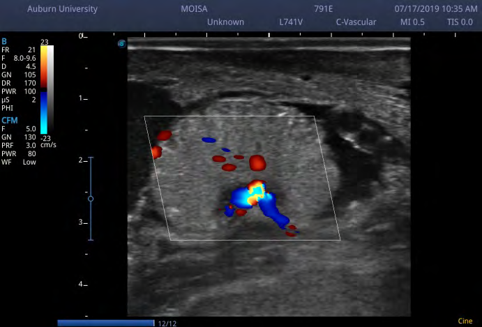 Figure 5: Representative sonogram showing a placentome in a pregnant, genotyped beef cow supplemented with rumen-protected niacin and exposed to endophyte- infected tall fescue seeds.
