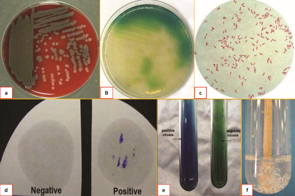 Figure 1: Colonies of P. aeruginosa on blood agar; b: Production of pigment on Muller Hinton agar by P. aeruginosa; c: Gram- negative rods of P. aeruginosa seen under microscope; d: Oxidase reaction; e: Citrate utilization test; f: Positive catalase test reaction.