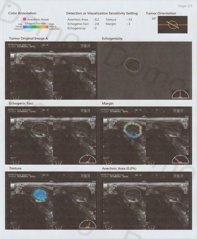 Figure 4: Cad Interpretation