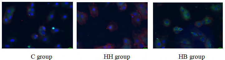 Figure 1: Immunofluorescence images of RPAECs in each group (×400).
