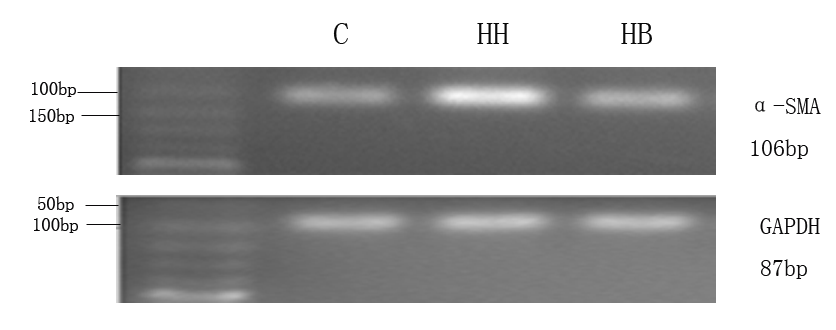 Figure 4: Bar graph of RPAECs proliferation in each group. **_P_<0.01 vs C group; ##_P_<0.01 vs HH group.