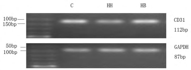 Figure 5: Migration of RPAECs in each group (×400).