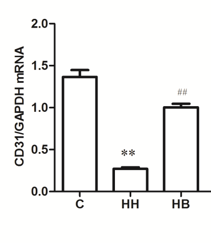 Figure 6: Bar graph of RPAECs Migration in each group. **_P_<0.01 vs C group; #_P_<0.05 vs HH group.