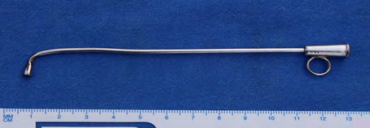 Figure 2: Instrument foreign body removal hook (Dr. Yadav’s F.B. Hook) for removal of foreign bodies.