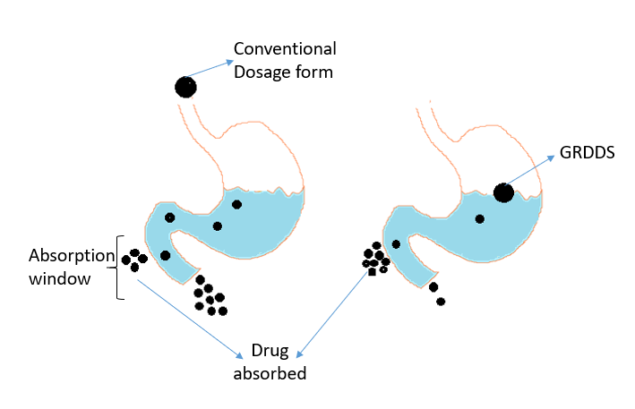 Figure 1: Conventional system and GRDDS.