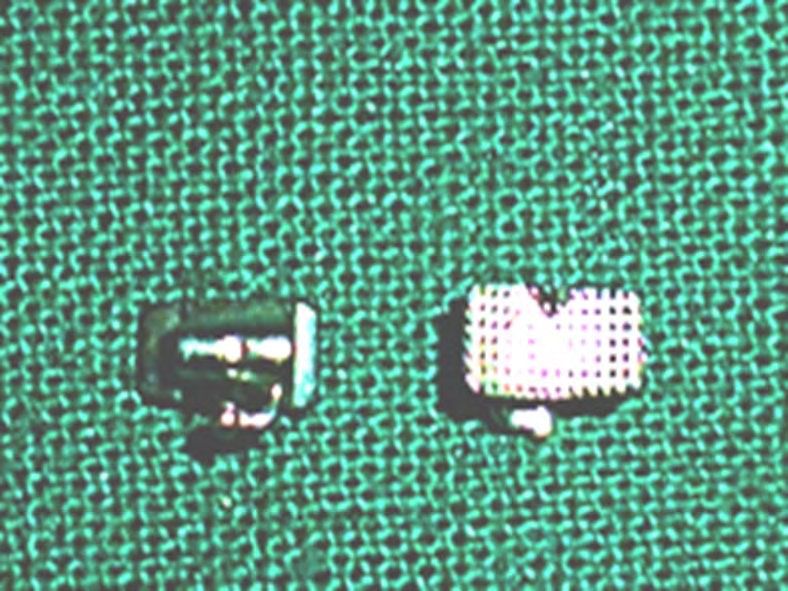 Figure 1: Molar tube of 0.018” Roth prescription.