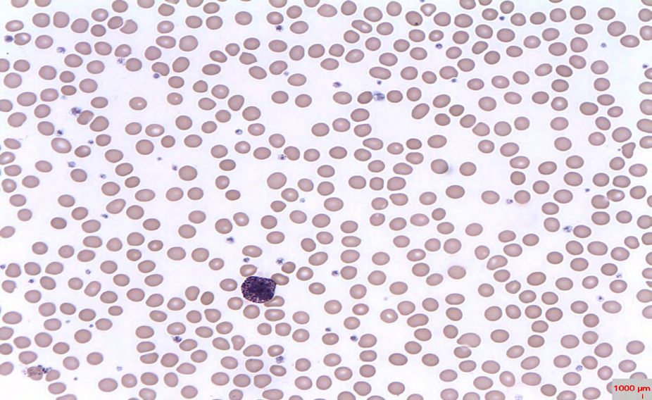 Figure 10: Picture of a Basophil.