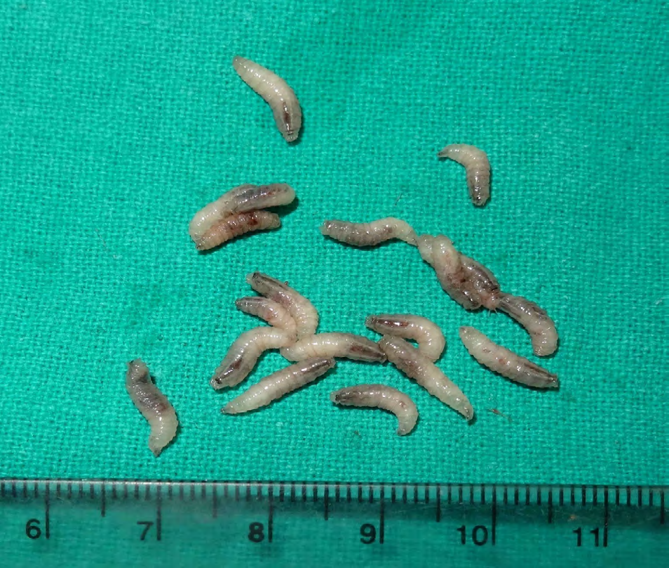 Figure 2: Photograph showing maggots after removal.