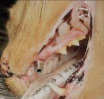Figure 10: Impression coping placed into the implant at the restorative phase following removal of the healing abutment.