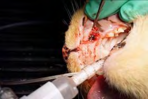 Figure 7: The soft tissue flap is approximated to achieve primary closure around the healing abutment and secured with interrupted sutures.