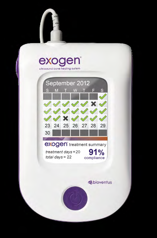 Figure 1: Support from the manufacturing company representative was available at all times during the course of the study. One nurse was trained/educated by the manufacturer to apply the ExoGen and deal with all patient queries.