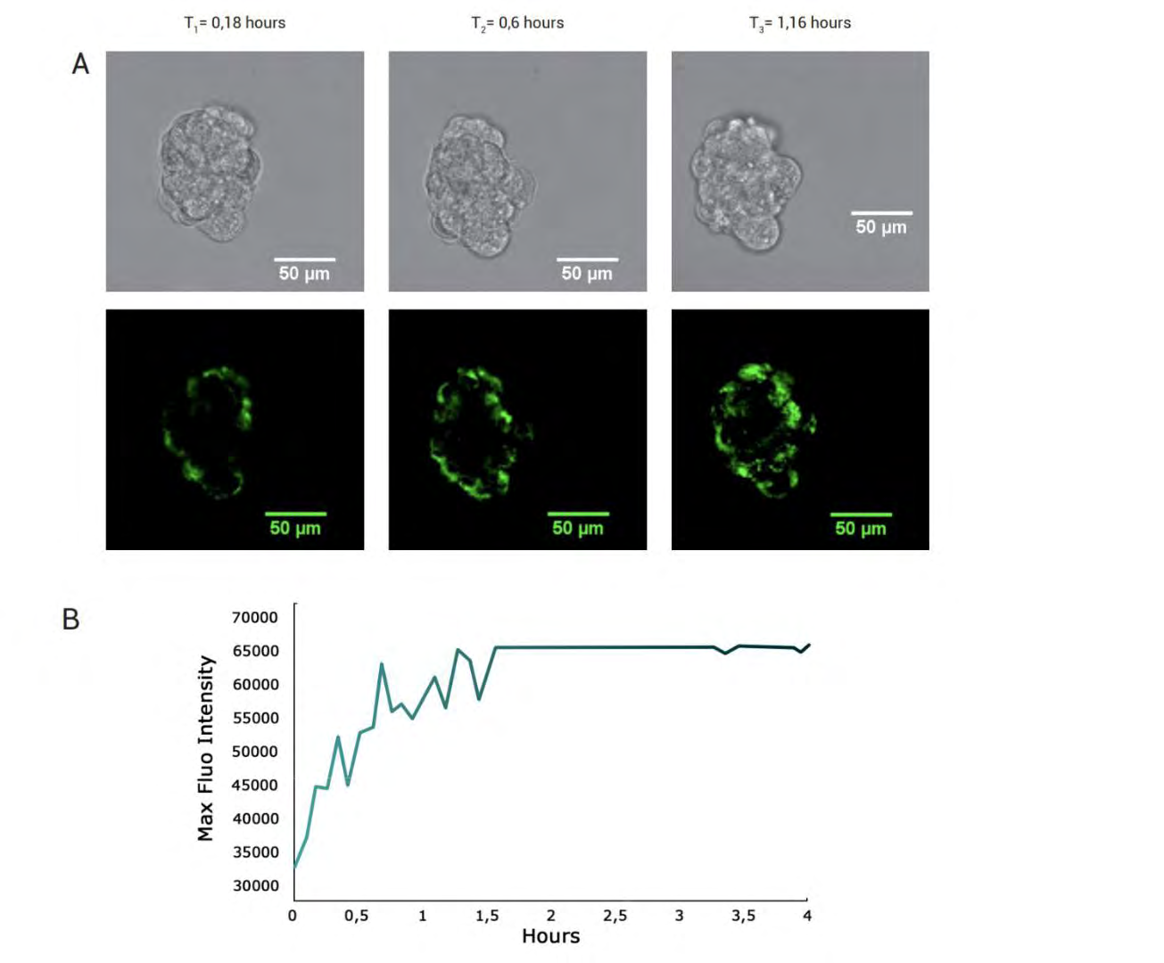 Figure 6: Bright-field analysis of MCF-7 spheroids grown in Sphericalplate 5D®