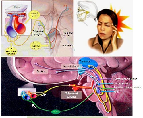 Figure 1: Pathogenesis of Headache: Neural pathway.