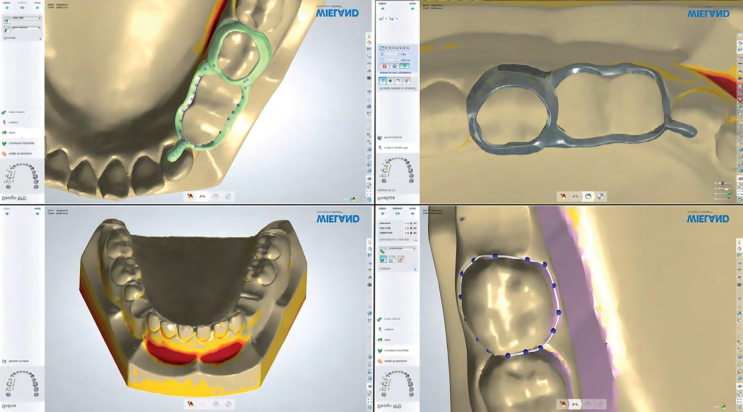 Figure 5: Digital pattern acquisition Thanks to CAD software and design of the devices.