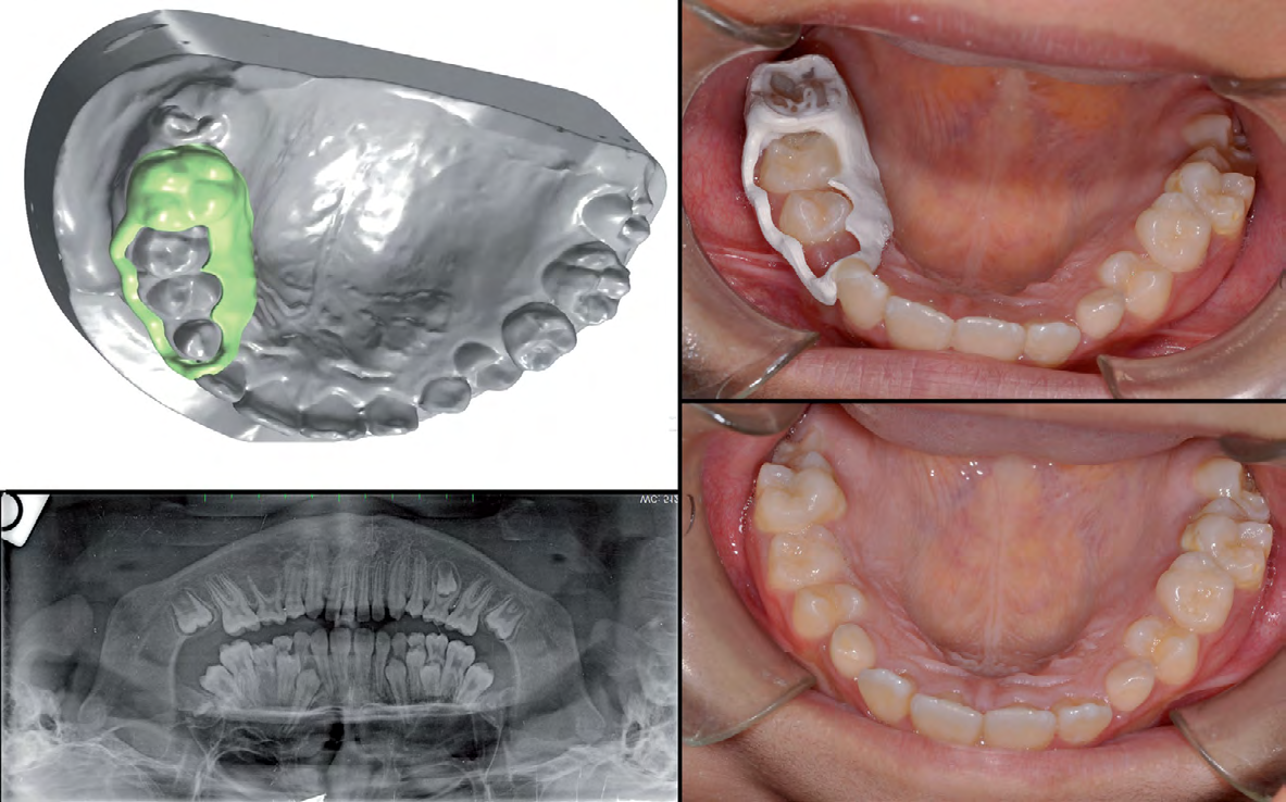 Figure 7: Second case report.