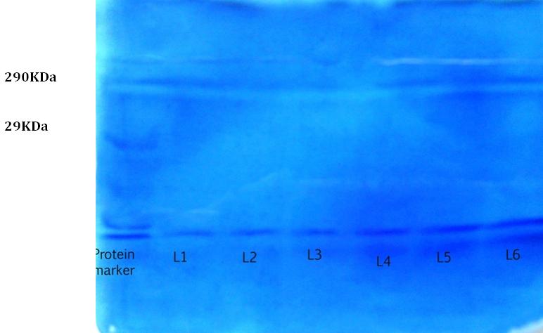 Figure 3: SDS-PAGE analysis of Chitin and chitosan associated proteins in _Panulirushomarus._