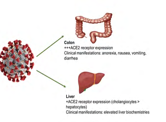 Figure 3: Liver injury in the setting of COVID19–related illness.