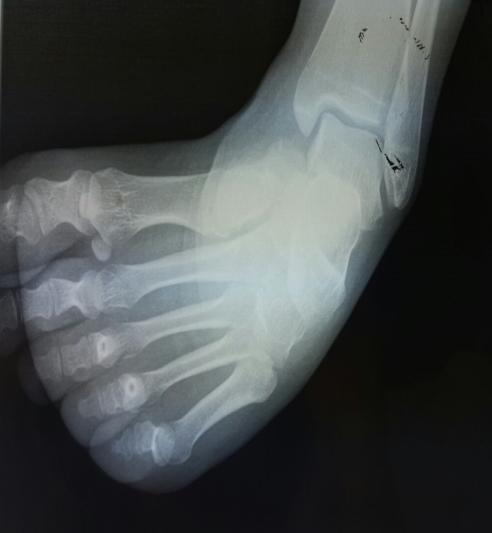Figure 3: Scannographic reconstruction.