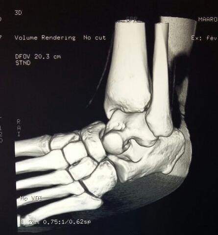 Figure 4: Postoperative Radiography.