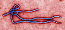 Figure 1: Ebola virus.
