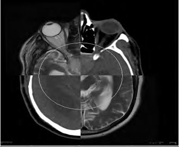 Figure 2: Recalling between Dosimetric scanner/MRI.