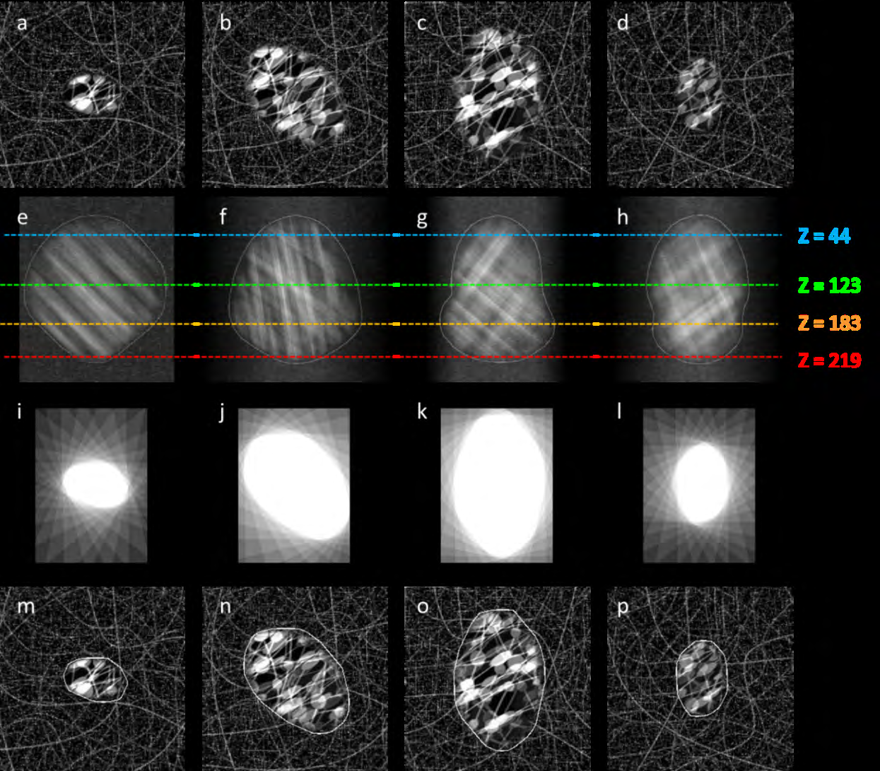 Figure 8: Top row: Slices of designed phantom at different levels (the x-y plane images); Second row: Projections of the phantom from different angles (the MIP images), delineations were performed by an operator; Third row: Back projection of lines from the MIP images, the region formed by all intersections of the back projection indicates the shape of AVM; Forth row: Retrieved contours of the simulated AVM are superimposed on the original sectional images.