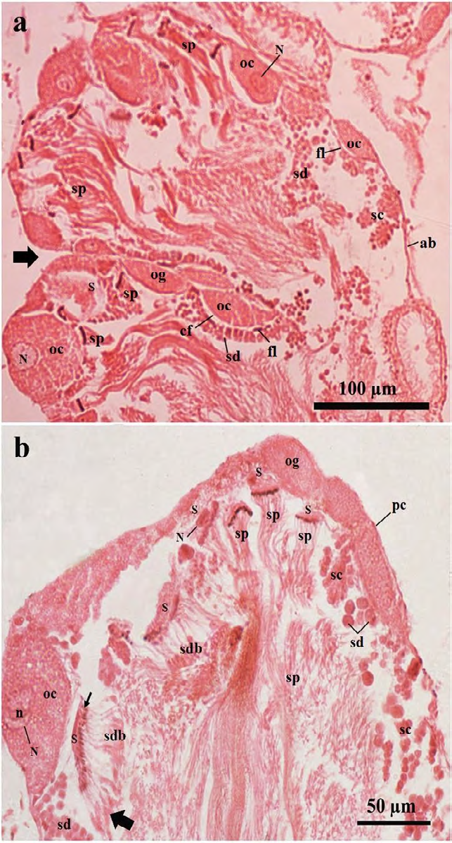 Figure 6: Photomicrographs of a part of the ovotestis acini of treated _Onchidium tigrinum_. a, The ovotestis of only mantle pricked slugs (in Pot-B). Bold arrow indicates the acinar junction. b, The ovotestis of the SSAE treated slugs (in Pot-C) without mantle pricked. The characteristics of the acinar components were almost similar between the individuals from both the Pot-B and Pot-C and those were mostly similar as found in the ovotestis of the control individuals (in Pot-A). Note the residual cytoplasmic materials in the developing spermatids were gradually moved toward the tail region (bold arrow) of these elongated cells. Arrow indicates the head of the developing spermatid bundle. Abbreviation: ab, acinar boundary; cf, follicular cleft; fl, follicular layer; ia, interacinar zone; ic, interacinar cell; n, nucleolus; N, nucleus; og, oogonium; oc, oocyte, pc, periacinar cell; S, Sertoli cell; sc, spermatocyte; sd, spermatid; sdb, spermatid bundle; sp, sperm.