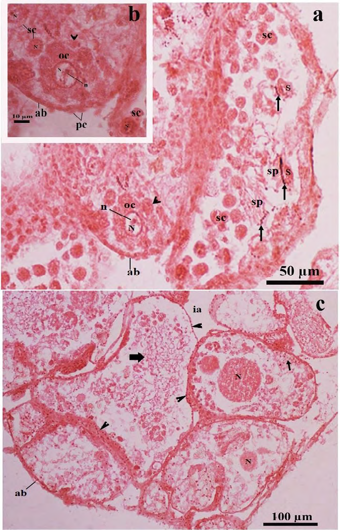 Figure 8: Light microscopic photomicrographs of a part of the ovotestis of the SSAE treated- mantle pricked _Onchidium_ _tigrinum_ (in Pot-D). a, The acinus was composed of characteristically distorted oocyte without covering of the follicular layer. The oolemma bulges outward and separated as small ooplasmic blebs (arrow head) from the oocyte. These blebs included a portion of the ooplasm into them. Arrow indicates the head of the developing sperms. The sperm heads were very loosely adhered to the residual part of the Sertoli cell. b, Enlarged view of the distorted oocyte of the figure A, showed distinct ooplasmic bleb (arrow head) was separated from the oocyte. c, Overall acinar constituents in most of the acini were drastically changed. The cytoskeleton of the developing oocytes in most of the acini were damaged. The cytoplasm free nucleus of the oocyte was moved toward the acinar lumen in many acini. Thin arrow indicates nuclear materials of developing spermatogenic cells. Bold arrow indicates the hazy appearance of the sperm tails. Arrow head indicates granulated acinar boundaries.