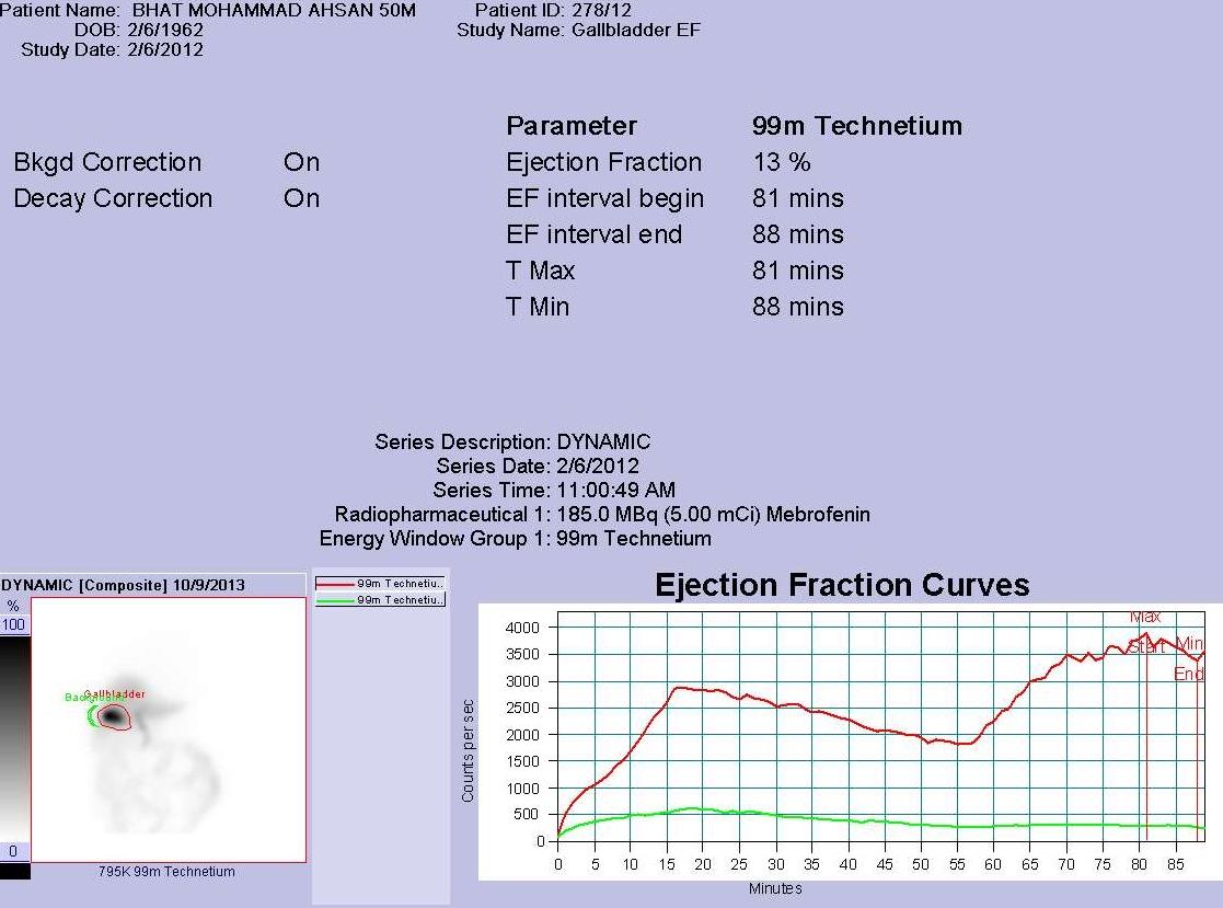 Figure 1: showing decreased ejection fraction of gall bladder (delayed filling and emptying).