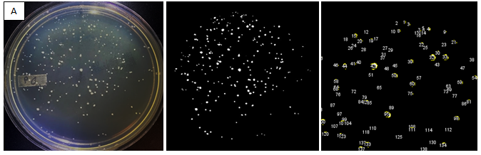 Figure 2: (A) An image of a representative plate with bacteria colonies and (B) the same image processed and analyzed using ImageJ. (C) A magnified section of the processed image is shown with colony counts in the selected region.