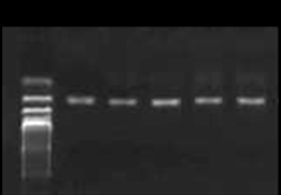 Figure 1: Post digestion results showed 77 and 28bp bands for AA genotype, 105, 77 and 28 bp for AC genotype as shown in Figure 2. The AA genotype frequency is 94% in the MI group and 71% in the controls, while AC genotype frequency is 6% in patients group and 29% in controls. There was no subject with CC genotype in both patients and control group Figure 3**.** The frequency of an allele was 0.68 in the patients with MI and 0.60 in the control group, while the frequency of T Allele was 0.02 in the patients with MI and 0.1 in the control group. All genotypes frequencies are in accordance with HDW equation (P values > .05).