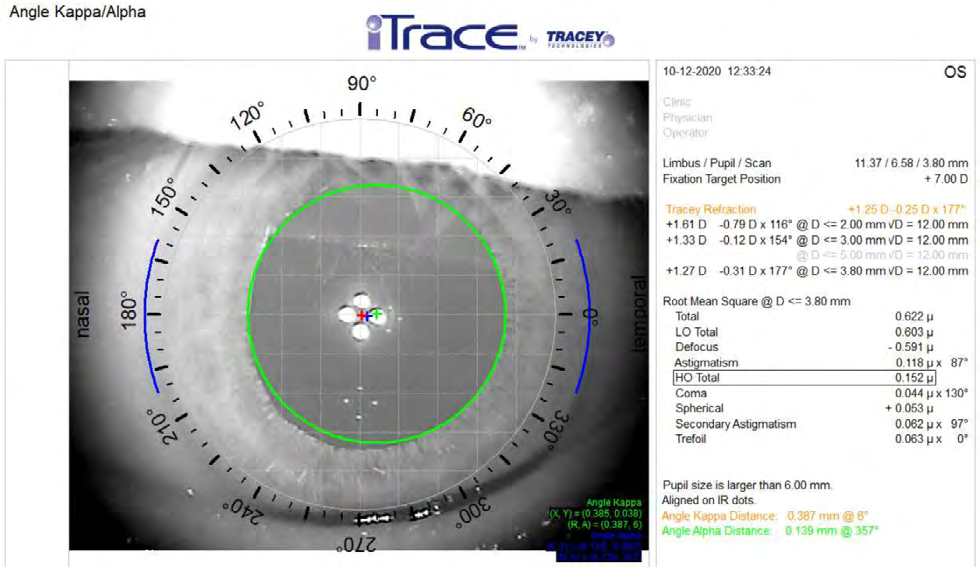 Figure 2: The module used by the iTrace analyzer to analyze the size and position of angles kappa and alpha relative to the visual axis.