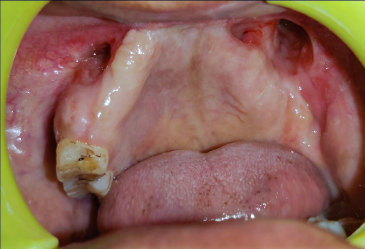 Figure 14: Post-Operative Follow-Up 8 Months.