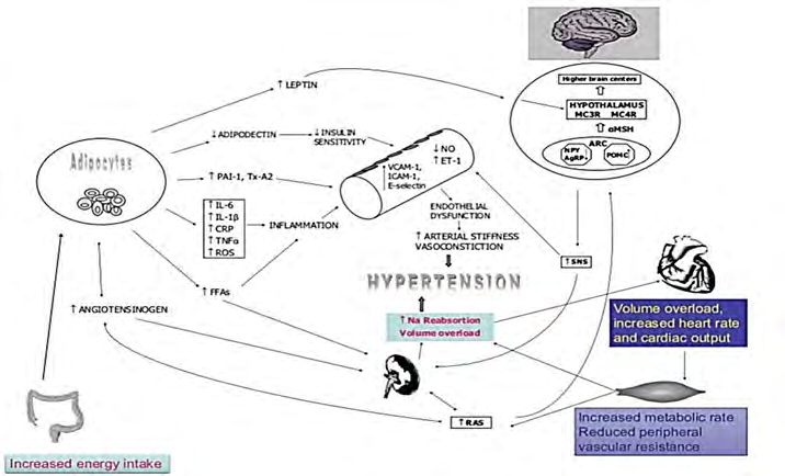 Figure 1: Mechanism of obesity-induced hypertension.