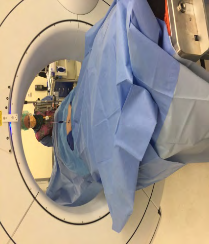 Figure 1: O arm in position over patient in supine position.