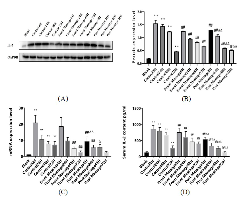 Figure 1: Changes of IL-2 expression in DOMS rats. Data were mean±SEM. A. Western blot analysis IL-2 protein expression in rats. ** P< 0.01 compared with blank group; ## P< 0.01 compared with the control groups in the same period; # P< 0.05 compared with the control group in the same period; ΔΔ P< 0.01 compared with the front massage groups in the same period; B. PCR detection for IL-2 mRNA. ** P< 0.01 compared with blank group; ## P< 0.01 compared with the control group in the same period; Δ P< 0.05 compared with the front massage groups in the same period; ΔΔ P< 0.01 compared with the front massage groups in the same period; C. ELISA showed the IL-2 content in rats. ** P< 0.01 compared Blank group; # P< 0.05 compared with the control group in the same period; ## P< 0.01 compared with the control group in the same period; ΔΔ P< 0.01 compared with the front massage groups in the same period.