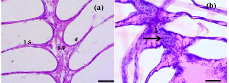 Figure 2: Histopathology of mud crab gill: (a) Control; (b) Contaminated with diesel pollutant, arrows indicate necrosis (1) (Magnification 400×).
