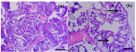 Figure 3: Histopathology of the mud crab hepatopancreas: (a) Control; (b) Contaminated with diesel pollutant, arrows indicate necrosis (1) and vacuolization (2) (Magnification 400×).