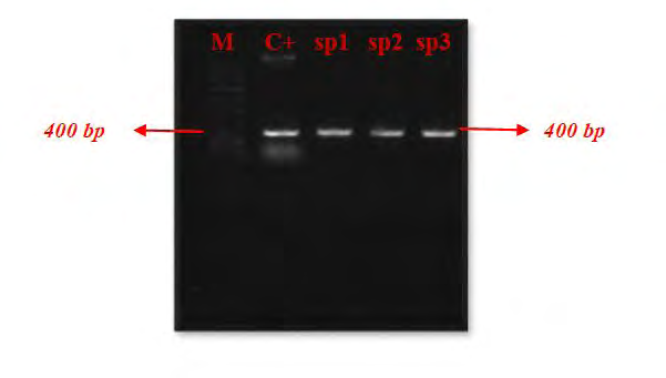 Figure 5: Confirmation of the transfer process of recombinant MaSp1 + pCAMBIA1304 vector to Agrobacterium tumefaciens cell (M: 1kb DNA ladder, c +: positive control, pc35sSp: MaSp1 gene).