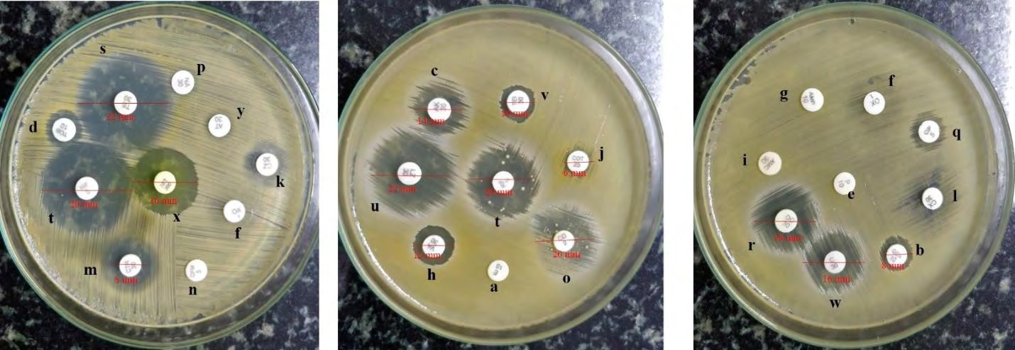 Figure 2: Antibiotic sensitivity pattern for S. aureus (refer Table 1 for a-z representation).