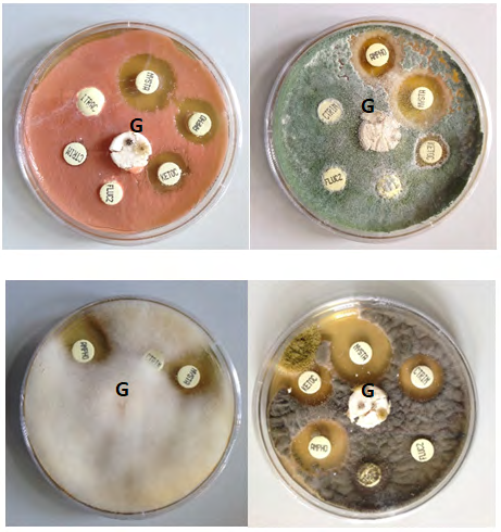 Figure 2: Antifungal susceptibility of fungi isolates associated with tinea capitis from school children. Amphotericin B (AMPHO), clotrimazole (CTRIM), fluconazole (FLUCZ), griseofulvin (GRISE) represented with a “G”, itraconazole (ITRAC), ketoconazole (KETOC) and nystatin (NYSTA).
