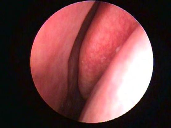 Figure 1: Pre-therapy.