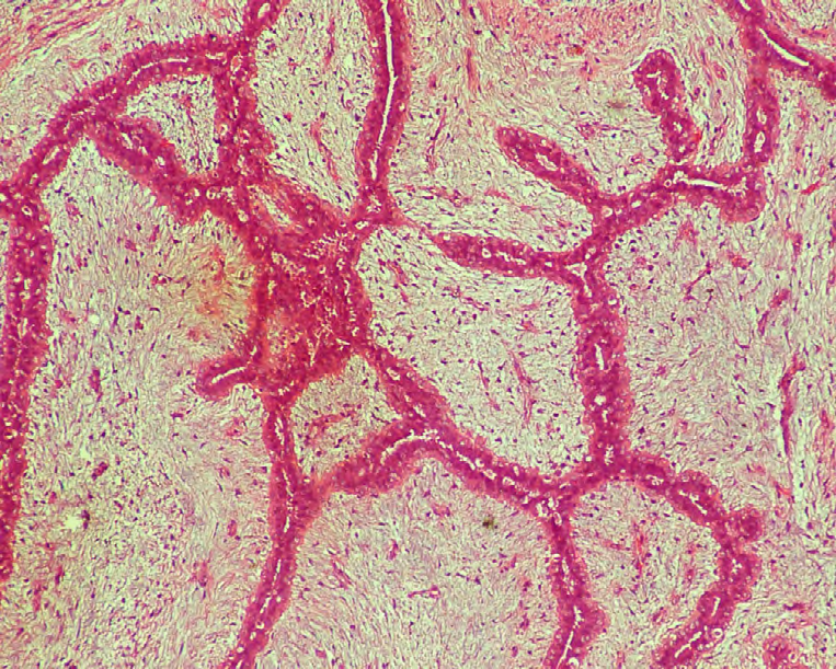 Figure 1: Fibroadenoma 10x (H&E).